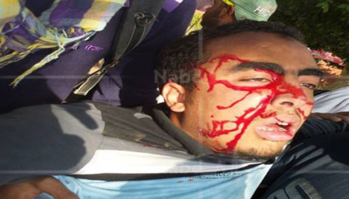 بالصور.. إصابات خطيرة بين طلاب جامعة أسيوط من جرَّاء اعتداء الأمن