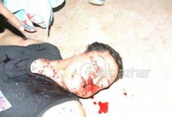 اتحاد طب أزهر دمياط: ما يفعله الانقلاب ضد الطلاب هو عين الإرهاب