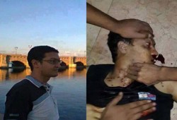 شهيد و50 مصابًا في اعتداء الانقلابيين على طلاب المدينة الجامعية بالأزهر