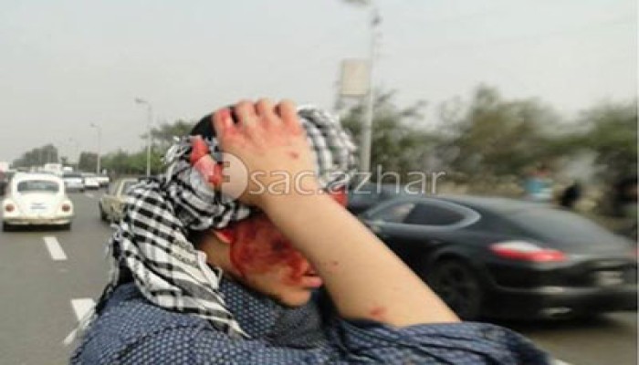 إصابات بين طلاب أزهر الدراسة في هجوم ميليشيات الأمن بالخرطوش والغاز