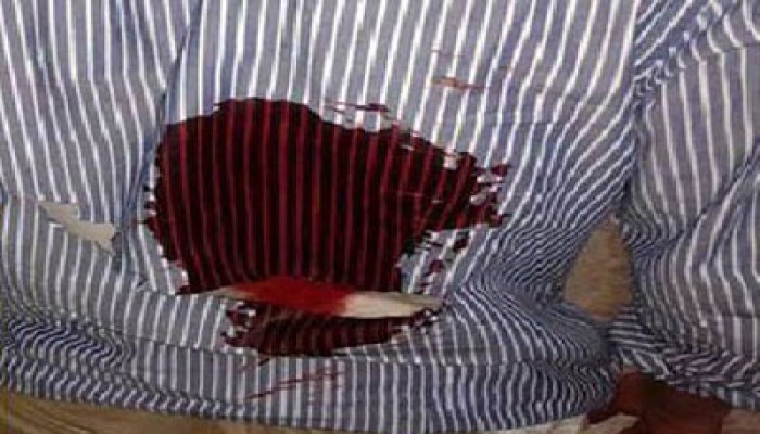 "اتحاد الأزهر": 50 إصابة خرطوش و4 برصاص حيّ في صفوف الطلاب