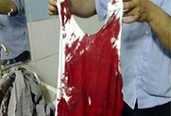 ضبط البلطجي المعتدي على النائب مصطفى محمد