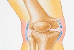 الطب البديل يساعد في علاج التهاب المفاصل