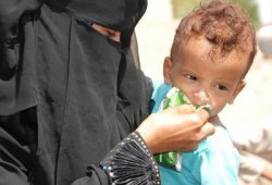 متحدث أممي: اليمن الأعلى في سوء التغذية بين الأطفال دوليًّا