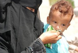 متحدث أممي: اليمن الأعلى في سوء التغذية بين الأطفال دوليًّا