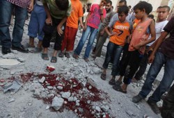 "اتحاد الأطباء العرب" يدين العدوان الصهيوني على غزة