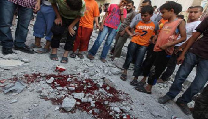 "اتحاد الأطباء العرب" يدين العدوان الصهيوني على غزة