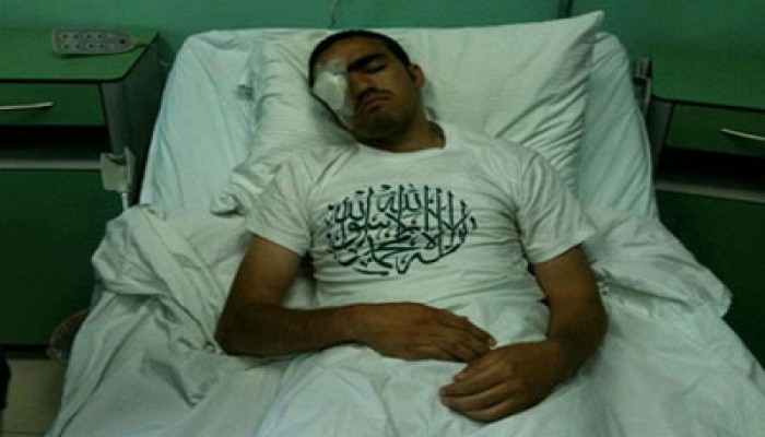 أجهزة السلطة تحاول اعتقال جريح من داخل المستشفى!