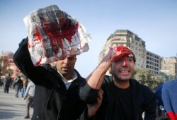 فكرة للتعرف على الأيدي الملوثة