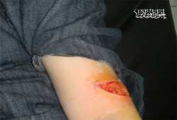 إغلاق مدرسة بأوسيم بعد الاعتداء على مندوبة الحرية والعدالة