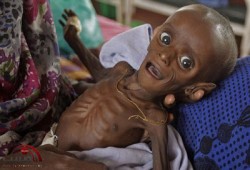 تراجع المجاعة في مناطق بالصومال