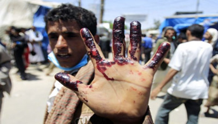 قتلى باليمن وإحباط محاولة لاغتيال الأحمر