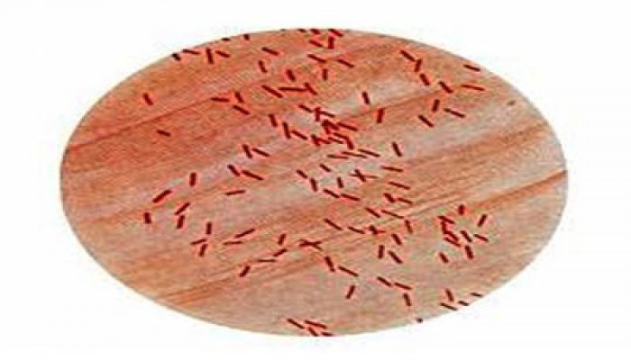 انتشار بكتيريا الليستيريا السامة في 18 ولاية أمريكية