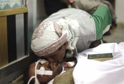 اليمن.. قصف بتعز وعشرات القتلى بصنعاء