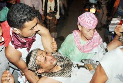 اليمن.. عشرات القتلى والجرحى في هجوم "صالح" على الثوار