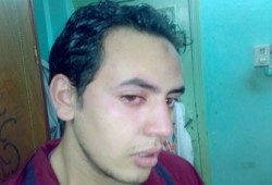 المنوفية: تقفيل وبلطجة وإطلاق النار على الناخبين