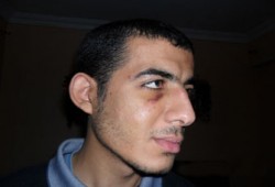 ضحية انتخابات كرداسة يروي تفاصيل تعذيبه