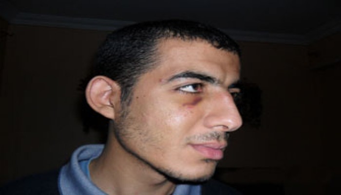 ضحية انتخابات كرداسة يروي تفاصيل تعذيبه