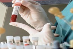 حكم الفحص الطبي قبل الزواج