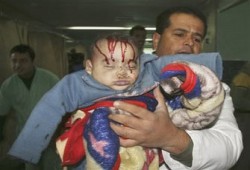 الفن ومجزرة غزة.. خطيئة التجاهل!!