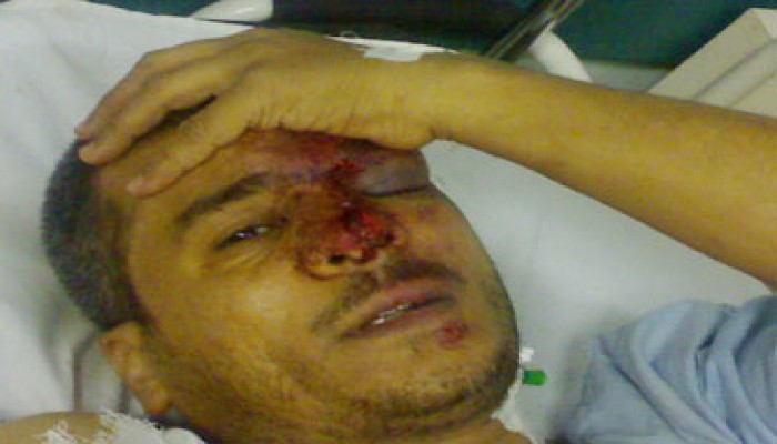 دفاع فارس بركات يطالب بلجنة محايدة من الطب الشرعي