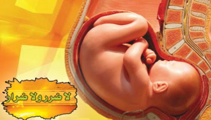 حكم ربط المبايض