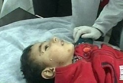 313 طفلاً شهداء العدوان الصهيوني على غزة