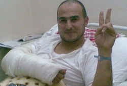 جرحى غزة.. قصص حية للصمود والعزة