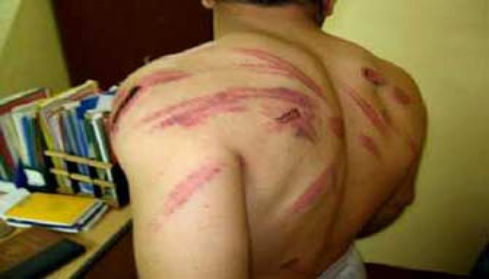 10 شكاوى أمام مجلس الشعب حول التعذيب في السجون
