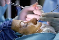 حكم عمليات التجميل