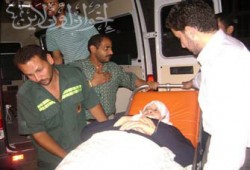 أم نضال تجري عملية قلب مفتوح بـ"القصر العيني"