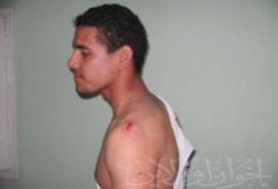 بيان عاجل حول تعذيب 3 عمال بالمنوفية