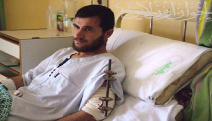 جرحى محرقة غزة في مصر: "لن تُقعدنا الإصابة"