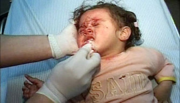 إعداد الأمة لمواجهة الأخطار