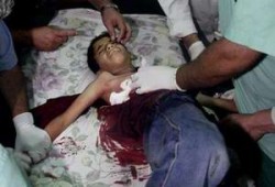 شهيدان و3 جرحى بقذيفة دبابة صهيونية في غزة