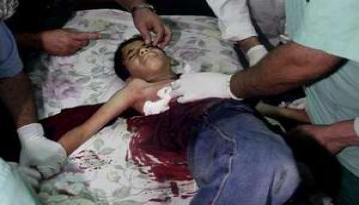 شهيدان و3 جرحى بقذيفة دبابة صهيونية في غزة