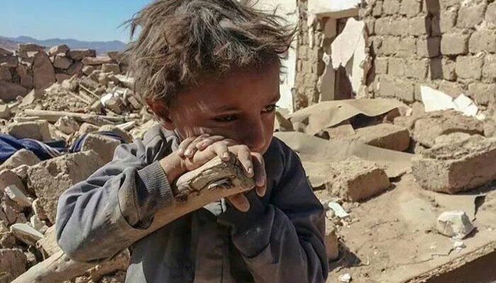 الأمم المتحدة: استمرار الحرب سيجعل اليمن أفقر بلد في العالم