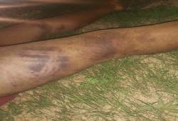 حوادث متكررة.. العثور على جثث مصريين بها آثار تعذيب شرقي ليبيا