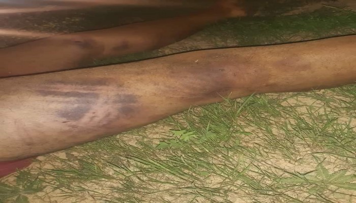 حوادث متكررة.. العثور على جثث مصريين بها آثار تعذيب شرقي ليبيا