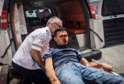 400 مصاب حصيلة الـ 24 ساعة الأخيرة في المسجد الأقصى