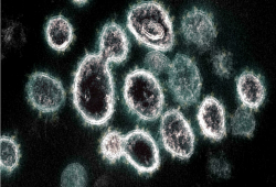 منظمة الصحة العالمية تحذر من سلالة جديدة لفيروس كورونا تدعى «مو»