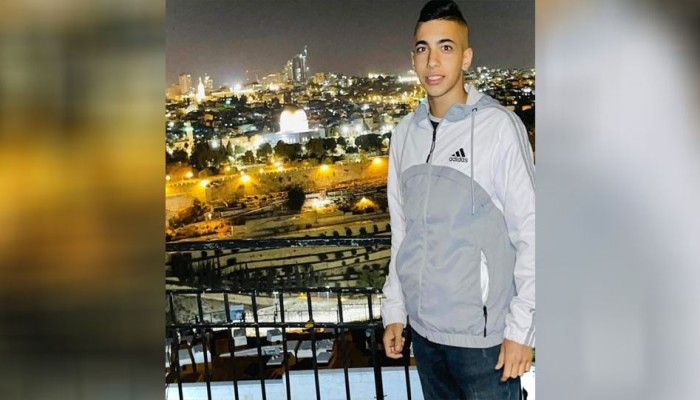استشهاد طفل مقدسي متأثرًا بإصابته برصاص الاحتلال