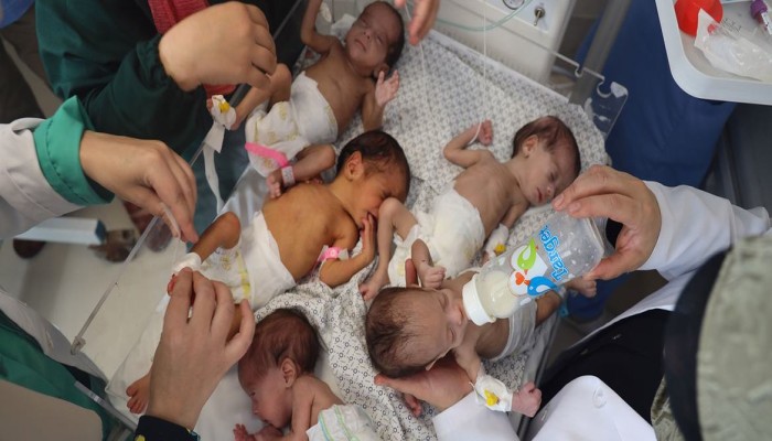 أونروا: الأطفال في غزة يموتون ببطء تحت أنظار العالم