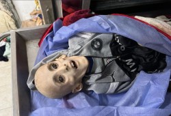 25 شهيدًا نتيجة الجفاف وسوء التغذية في غزة