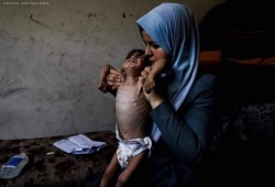 استشهاد الطفل الـ 40 بسبب المجاعة في قطاع غزة