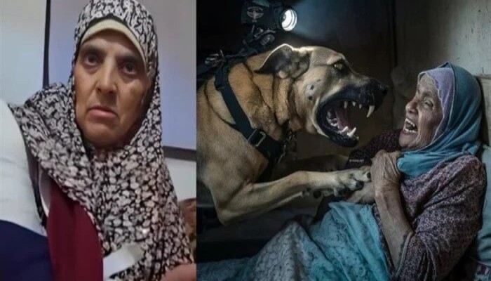 كلب جيش الاحتلال يهاجم مسنة فلسطينية.. وحشية الصهاينة في غزة