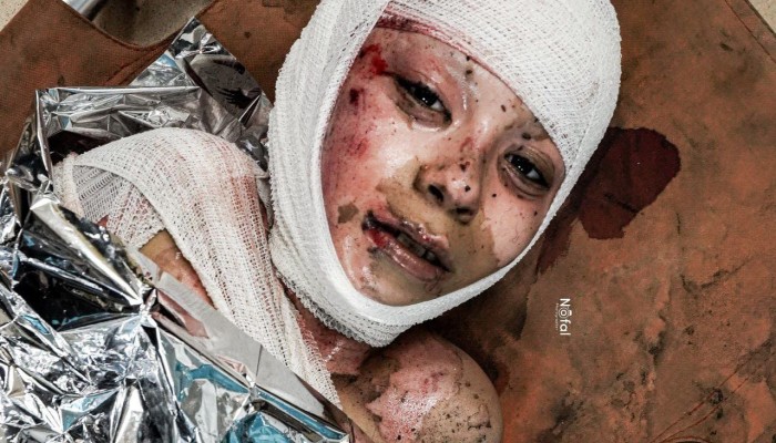 320 شهيدًا ومصابًا وصلوا مستشفيات غزة بأجسادٍ محروقةٍ