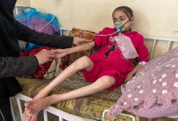15 ألف طفل في غزة مصابون بسوء التغذية الحاد