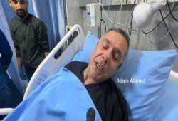 مدير مستشفى كمال عدوان بعد إصابته: مستمرون بعملنا الإنساني