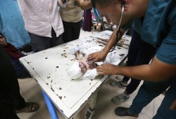 2500 طفل بغزة بحاجة إلى إجلاء طبي للعلاج بالخارج